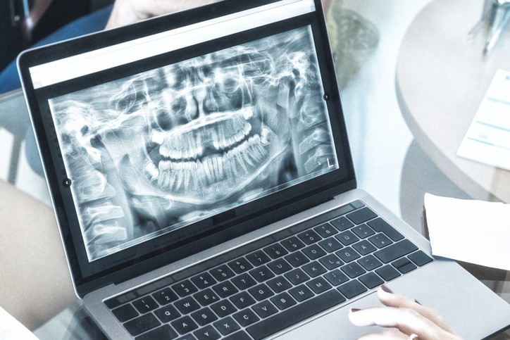 laptop with radiograph